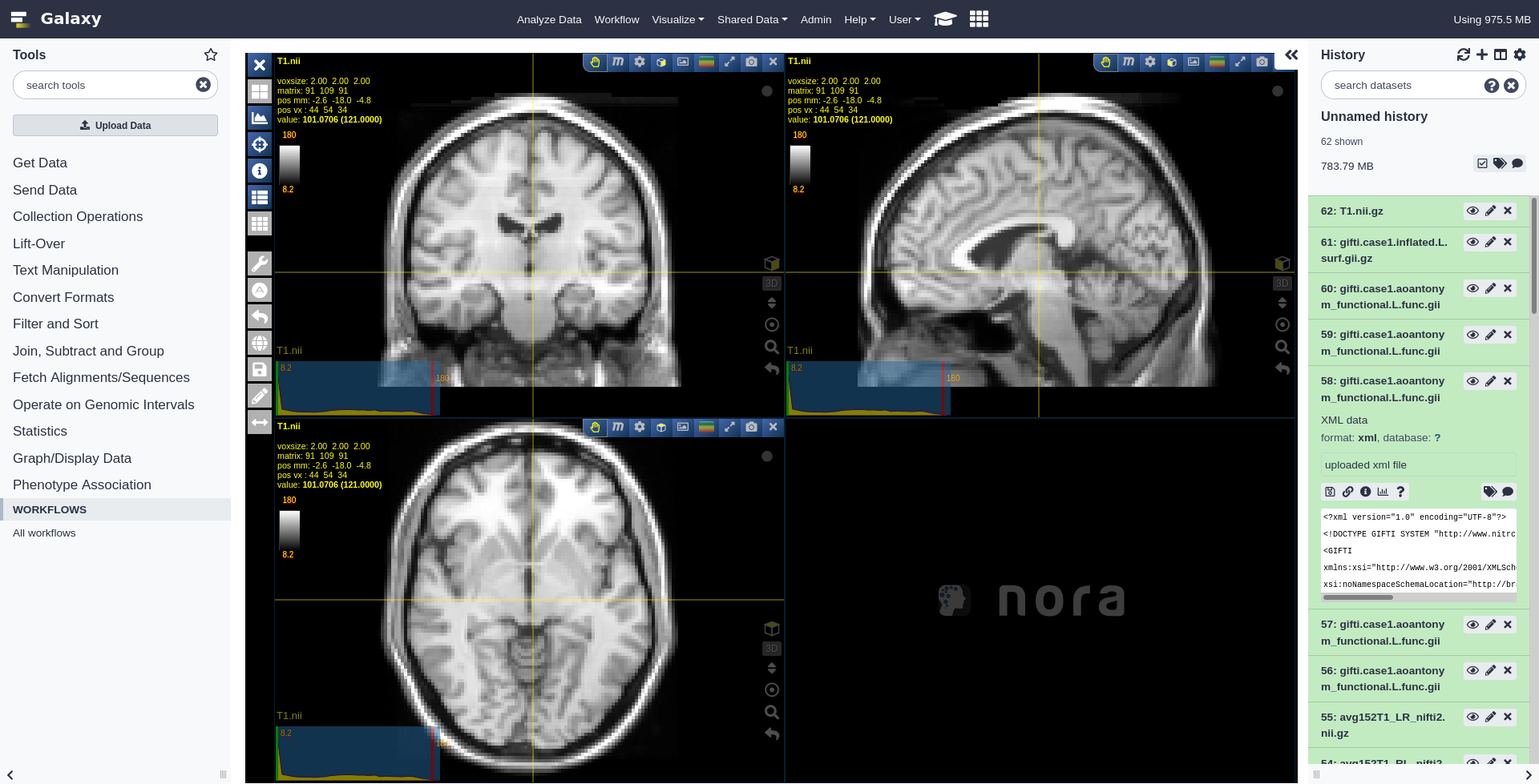 Screenshot of the NORA visualizer showing three views of a scan of a human brain.